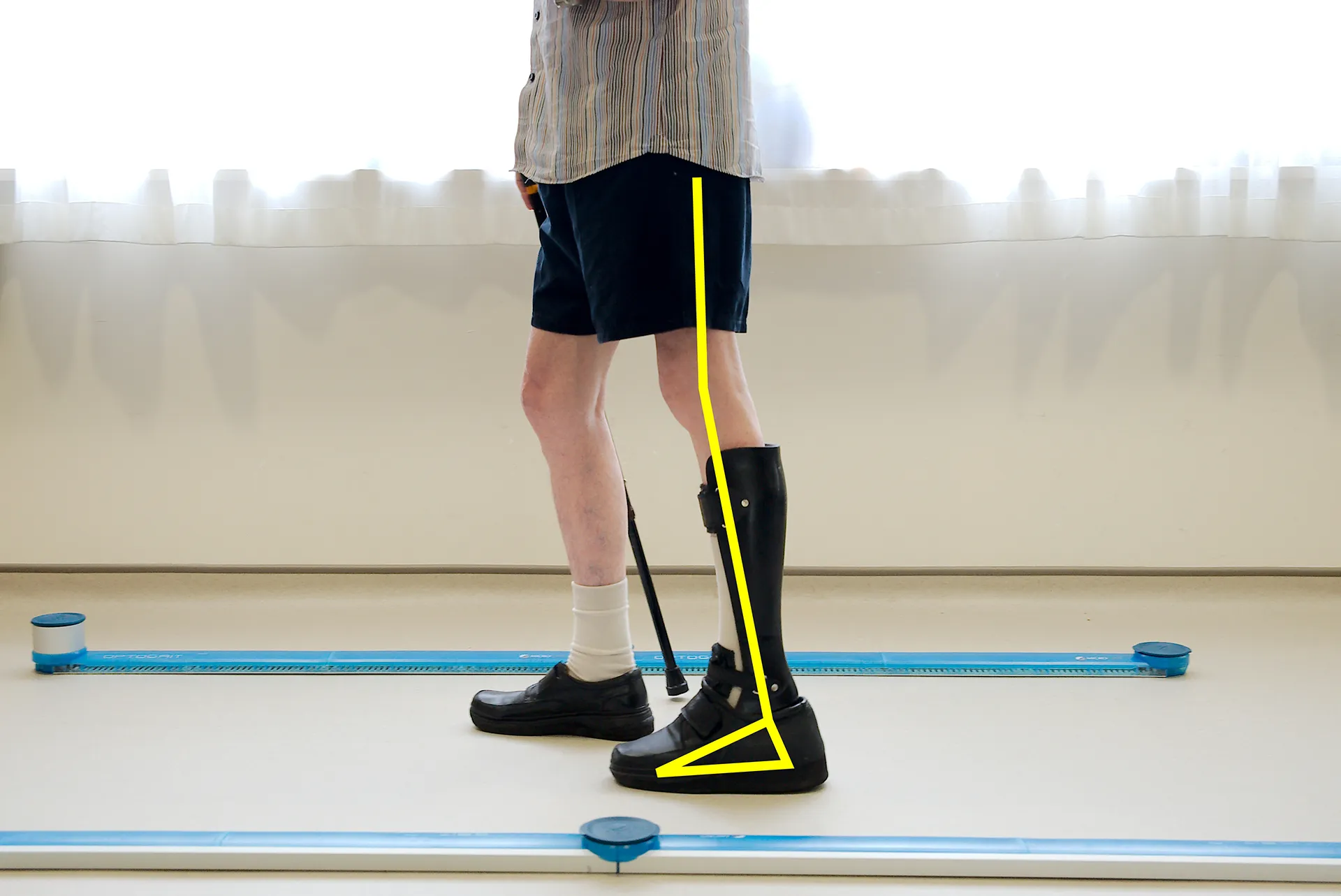 Gait Analysis