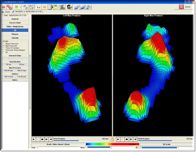 Pressure Plate image